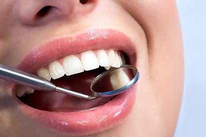 Testsieger Zahnzusatzversicherung 2017